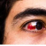 19 Reasons For Having Red And Bloodshot Eyes