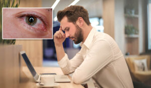 man having headache and an image of res eyes