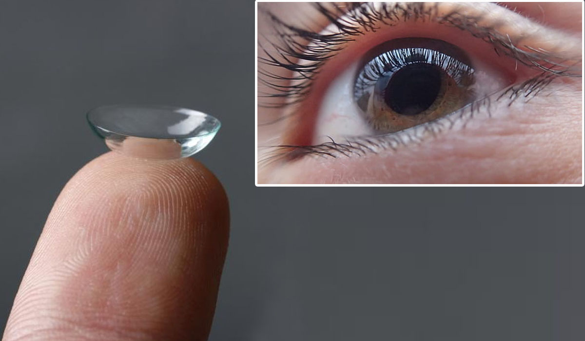 a photo of a contact lense and eye with myopia