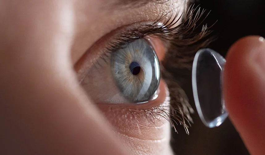 Ortho-K lenses reshape cornea overnight, providing clear vision without glasses.